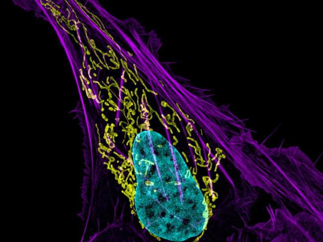 Colorized scanning electron microscope image of an osteosarcoma cell.