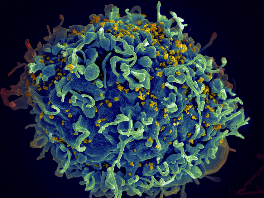 Latent HIV-infected T cells sleep with one eye open