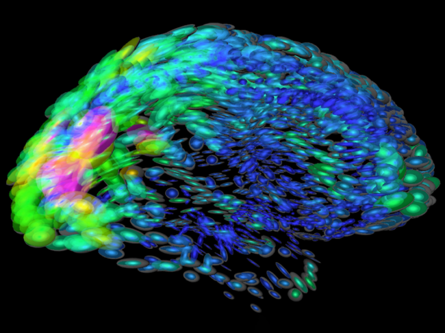 Brain map visualization of the neurological differences between two people.