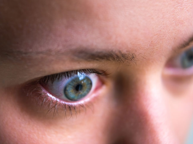 Close up of woman's bulging eyes