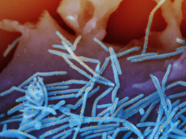 Scanning electron micrograph of human RSV virions