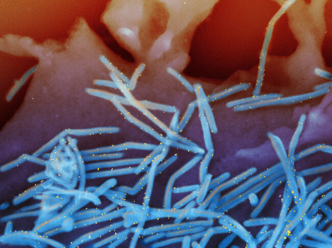 Scanning electron micrograph of human RSV virions