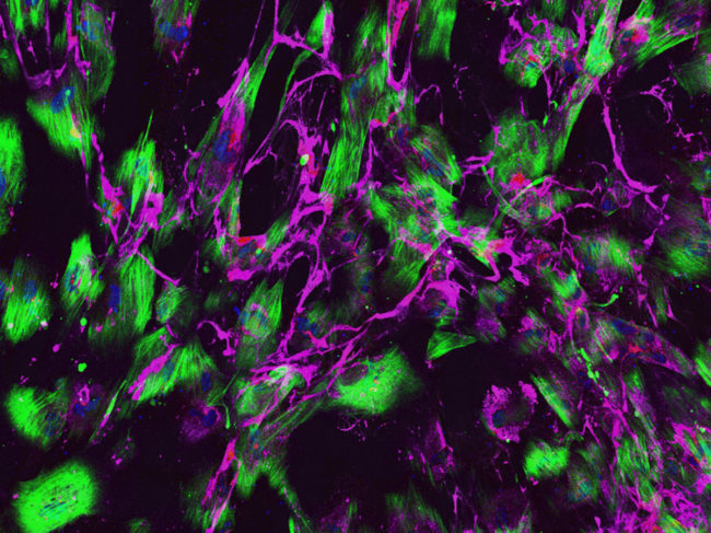 Cerebral small vessel disease under the microscope