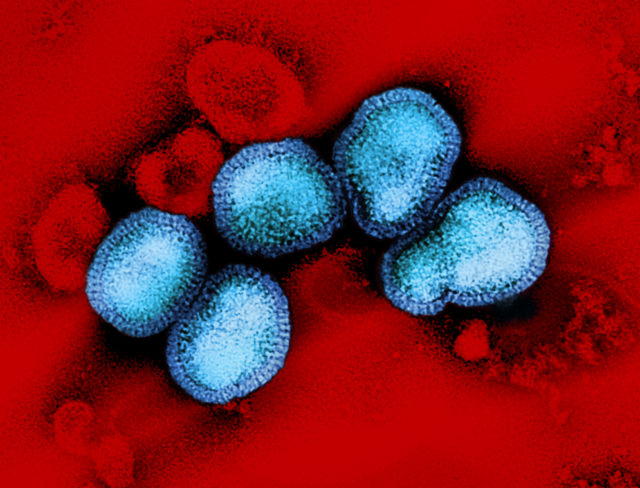 Influenza A virus (H3N2)