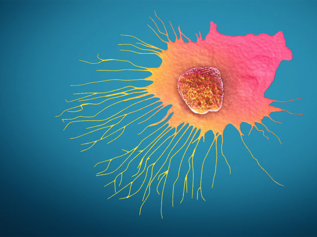 Scientific illustration of a migrating breast cancer cell 