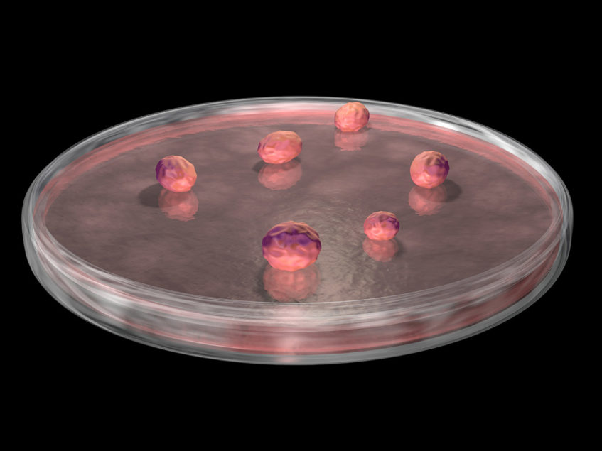 3d Organoids Arising From Amniotic Fluid Cells May Be A Potent Prenatal Tool Bioworld