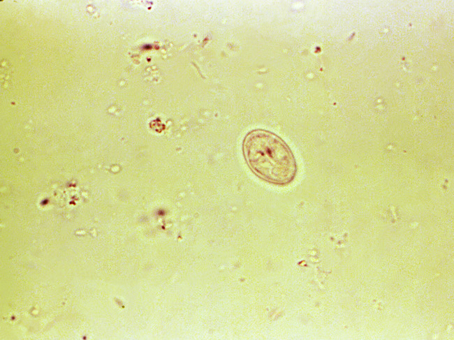 Photomicrograph reveals some of the ultrastructural details seen in a Giardia lamblia cyst