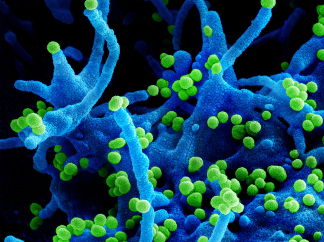 Scanning electron micrograph of Lassa virus budding off a cell.