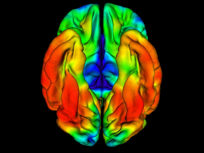 PET imaging of RELN-COLBOS (H3447R) carrier brain showing limited aggregation of tau