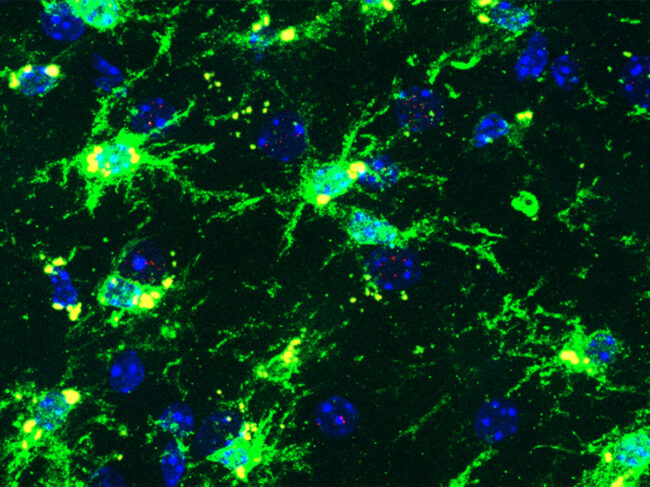 Inflammatory microglia from a female brain in a mouse model of Alzheimer's disease