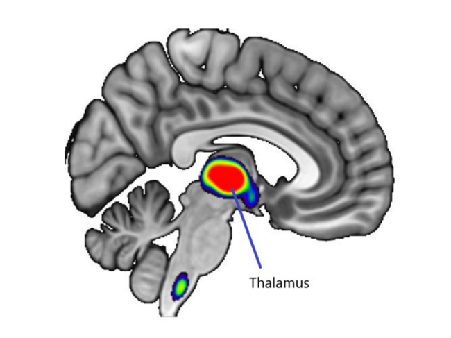 Brain cross section showing thalamus.