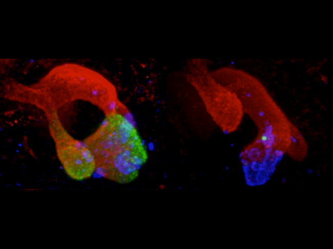 Embryonic multipotent pancreatic progenitors.