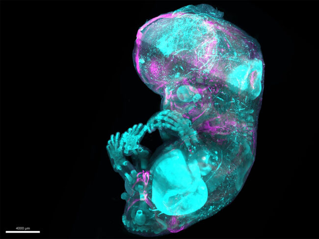 D-rendered image showing atlas of human embryonic skeletal development