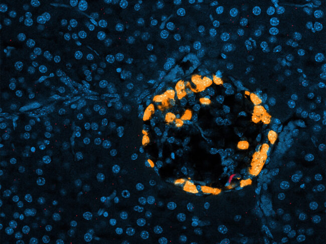 Immune cells (red) migrate to the pancreas and stimulate glucagon-producing cells (orange)