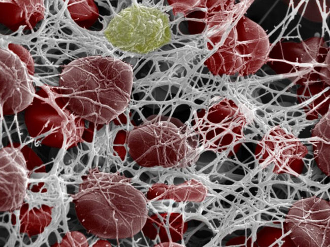 Red blood cells coagulating
