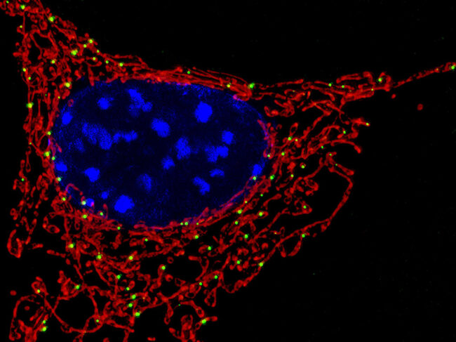 Mitochondria