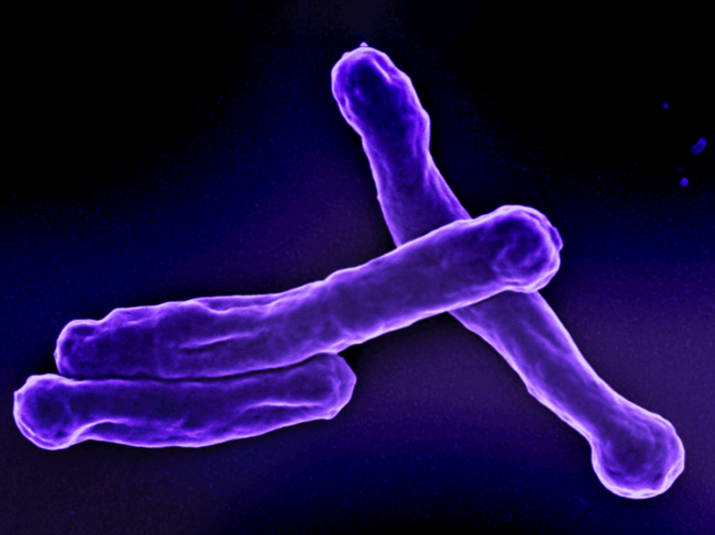 Mycobacterium tuberculosis