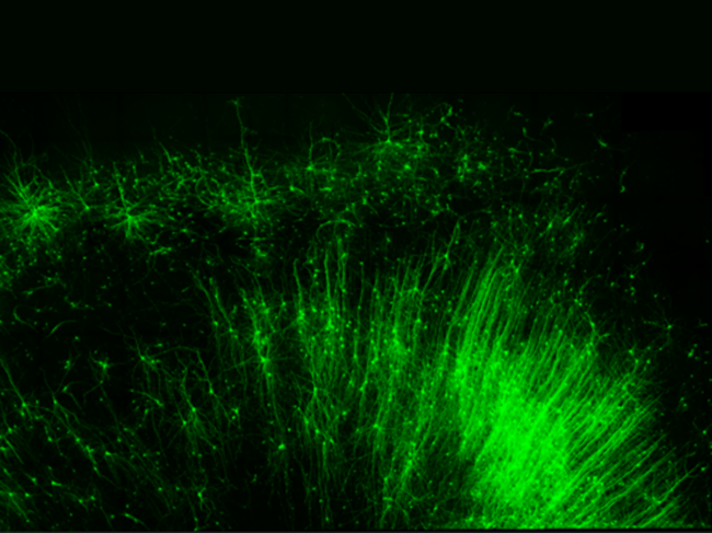 RNA targeting technology