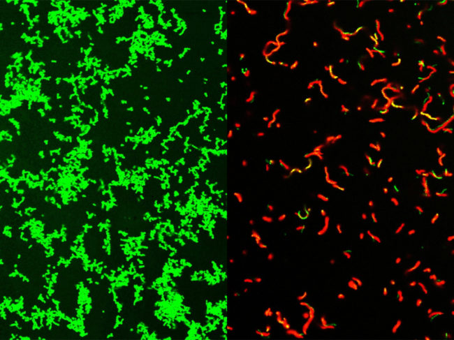 Streptococcus pyogenes before and after treatment