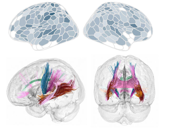 Changes in brain during pregnancy