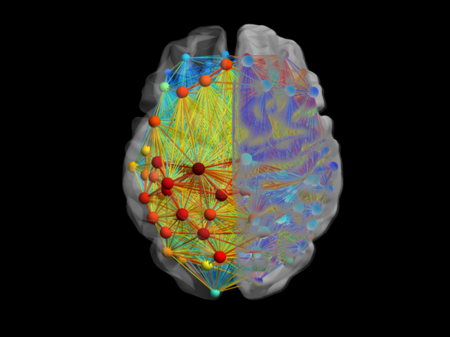 Brain connections