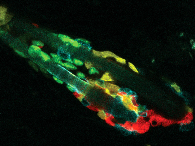 Hair follicle containing phagocytic stem cells