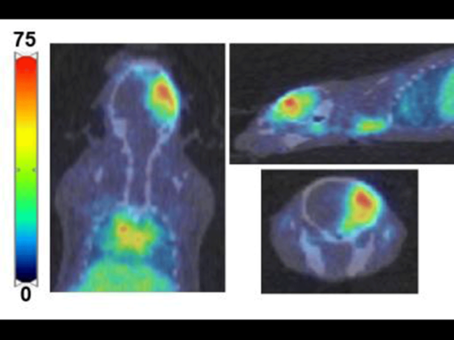 PET imaging