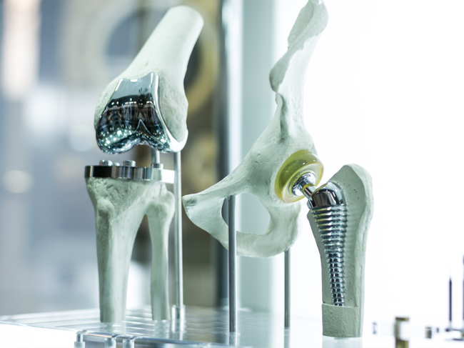 Orthopedics implants, joint-replacements