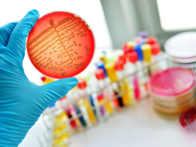 Gloved hand holding petri dish in lab