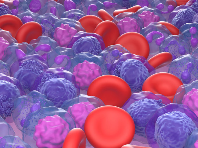 3D illustration of acute myeloid leukemia cells