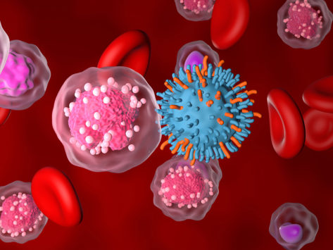 Car t cell therapy in acute lymphoblastic leukemia