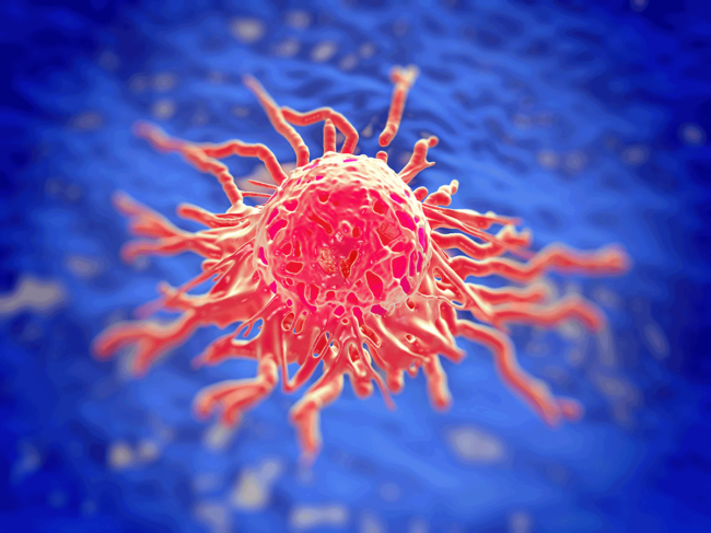 Cervical cancer cell