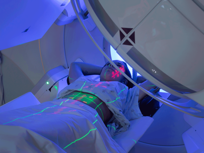 Woman receiving radiotherapy treatments for cancer