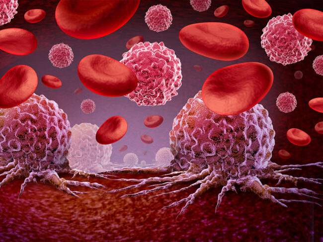 Art concept for hematologic cancer