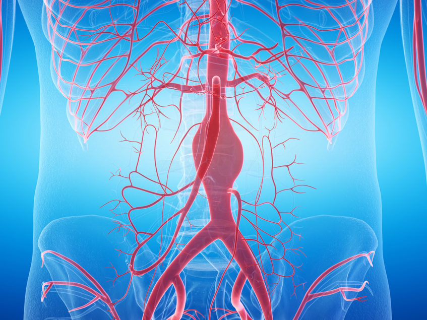 Notion-2 trial shows similar outcomes for TAVI and SAVR in low-risk ...