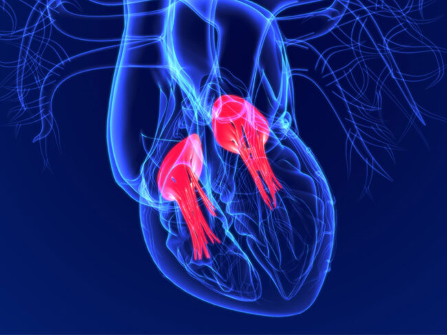 3D heart illustration showing tricuspid and bicuspid valves