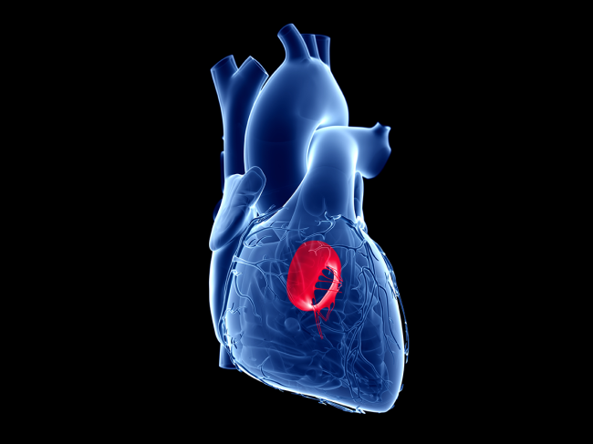 3D rendering of heart, mitral valve