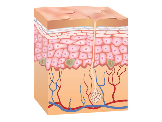 3D illustration of skin layers