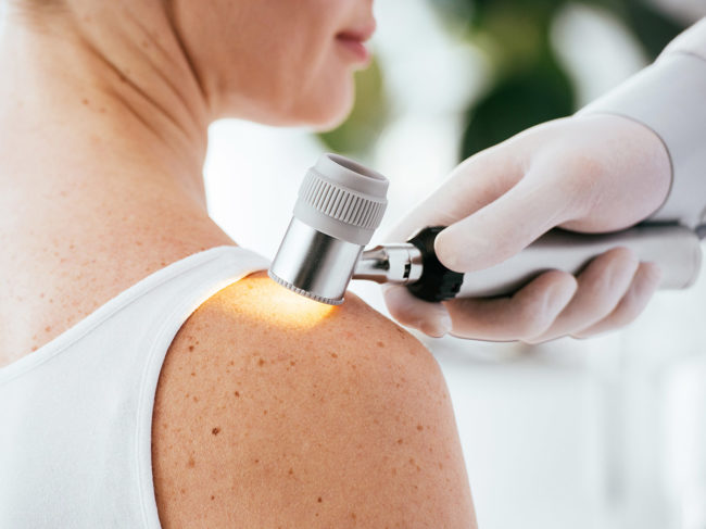 Skin exam with dermatoscope