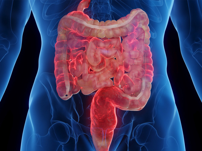 Illustration for inflammatory bowel disease