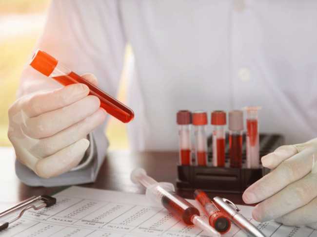 Test tubes with blood samples