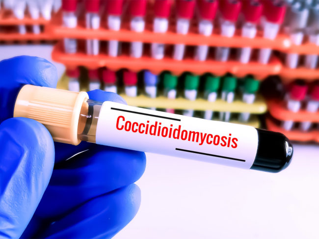 Blood test for Coccidioidomycosis infection