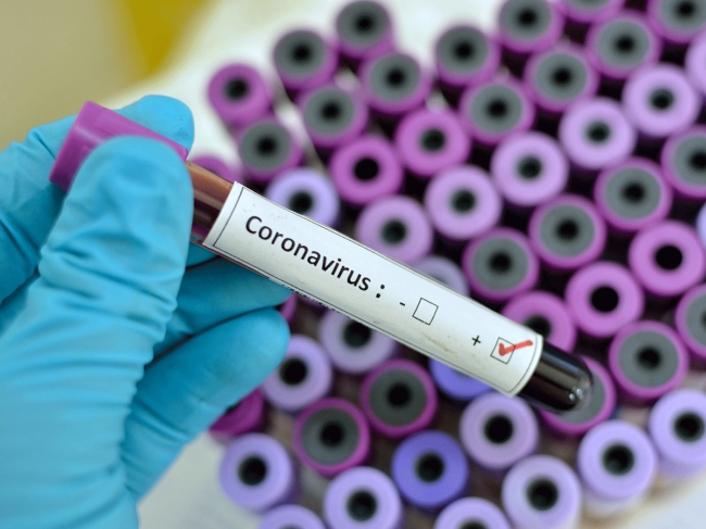 Coronavirus test tubes