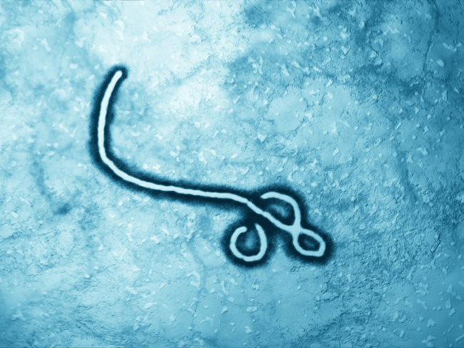 Ebola virus