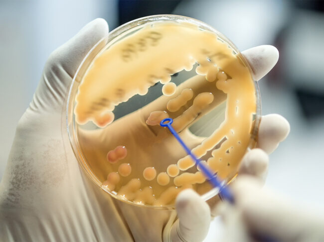 Klebsiella pneumoniae colonies in petri dish