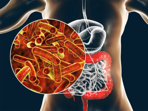 Illustration of Shigella bacteria infecting the large intestine