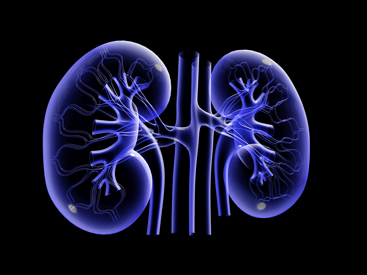 Genetic illustration of fibrotic kidney on Craiyon