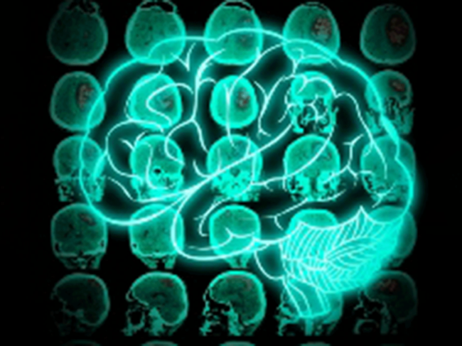 Brain scan illustration