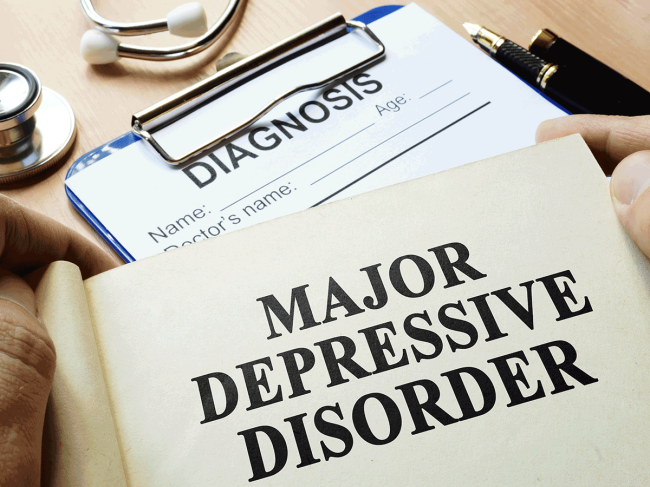 neurology-major-depressive-disorder