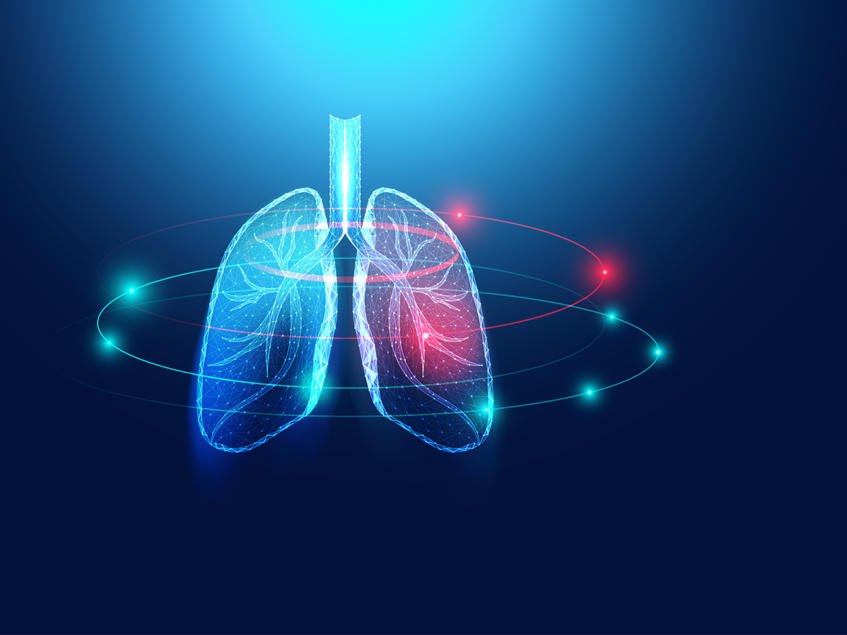 Insmed rises on positive data with Arikayce in phase III for MAC lung ...